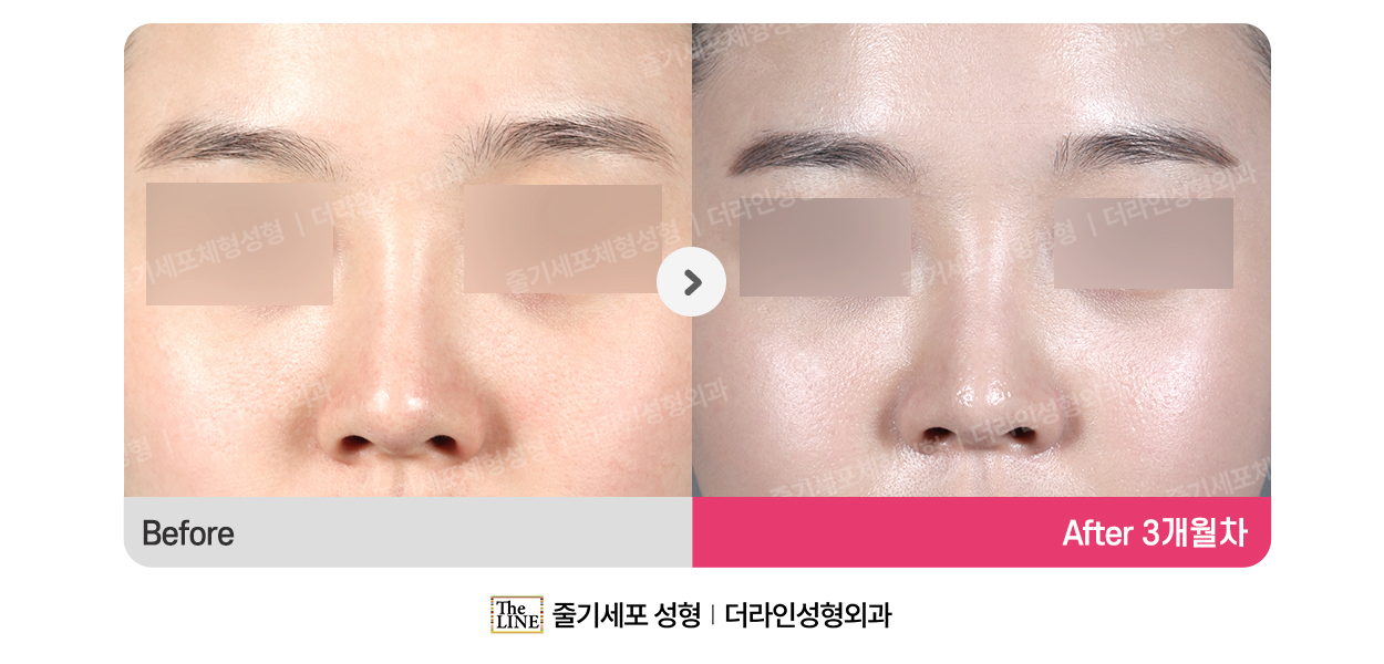 전사진