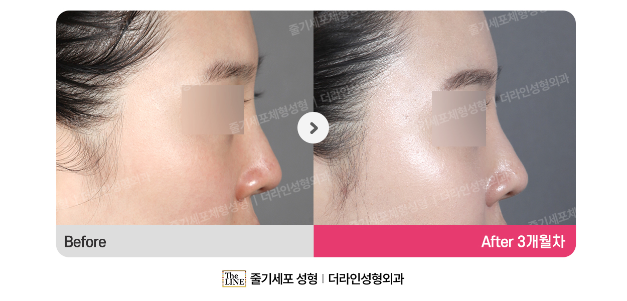 전사진