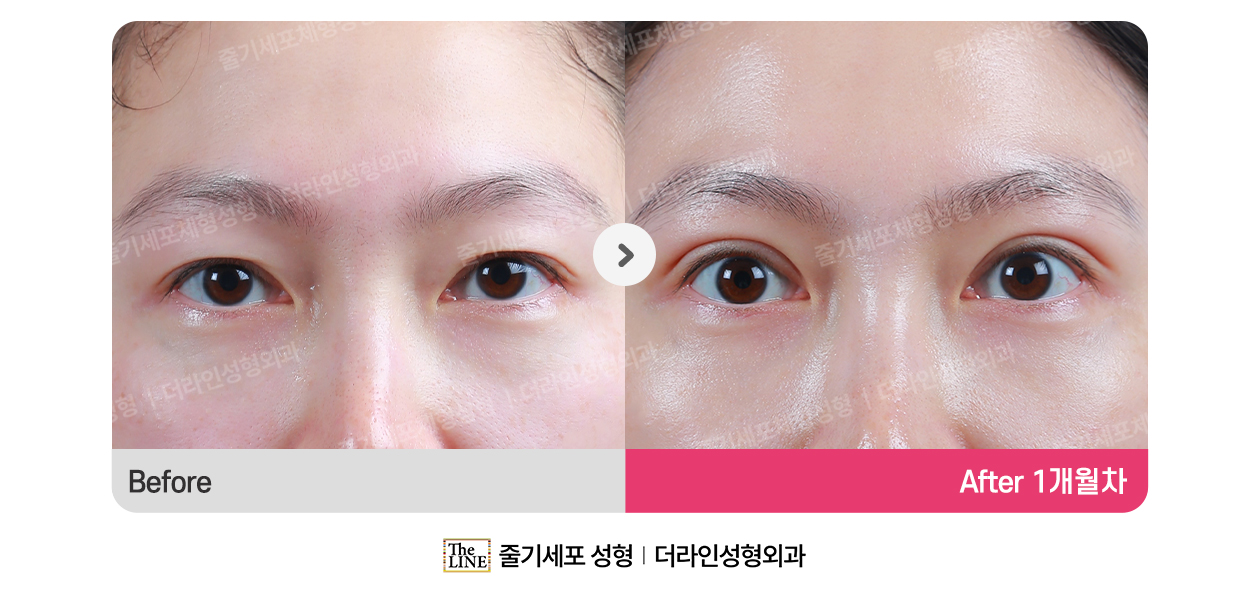 전사진