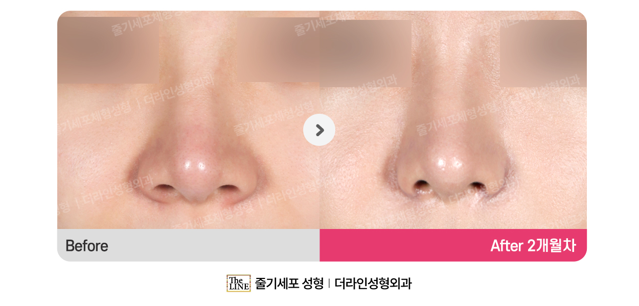 전사진