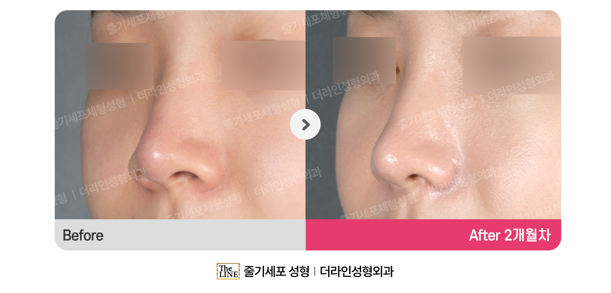 전사진