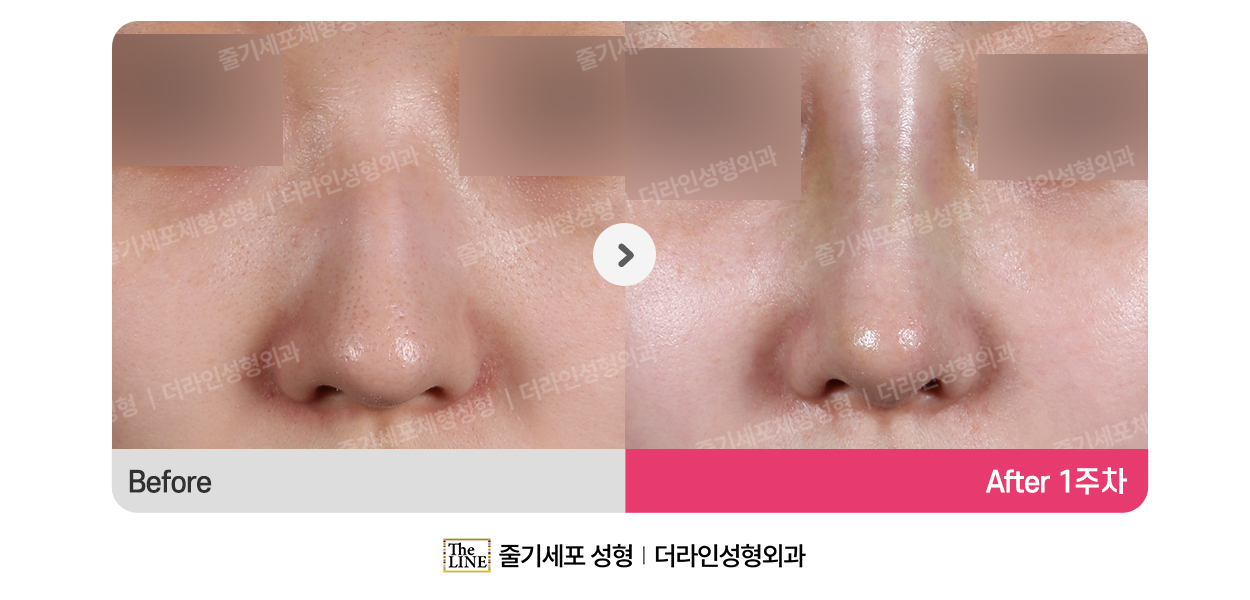 전사진