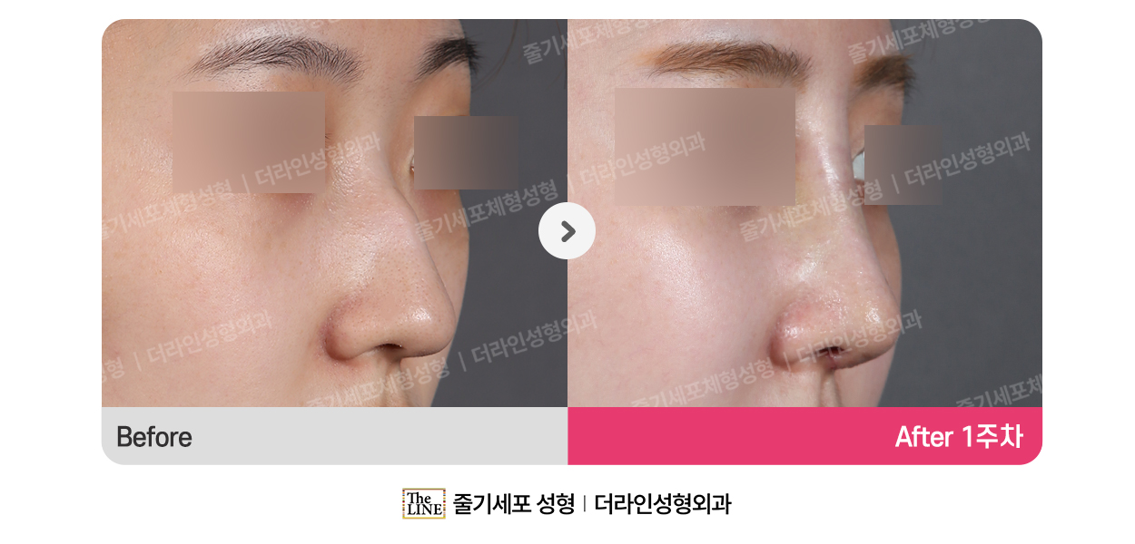 전사진