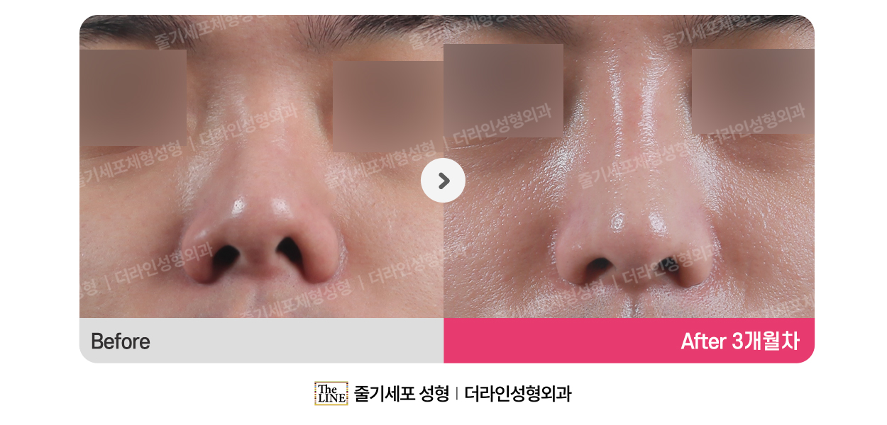 전사진