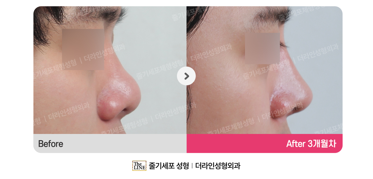 전사진