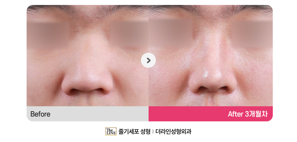 전사진