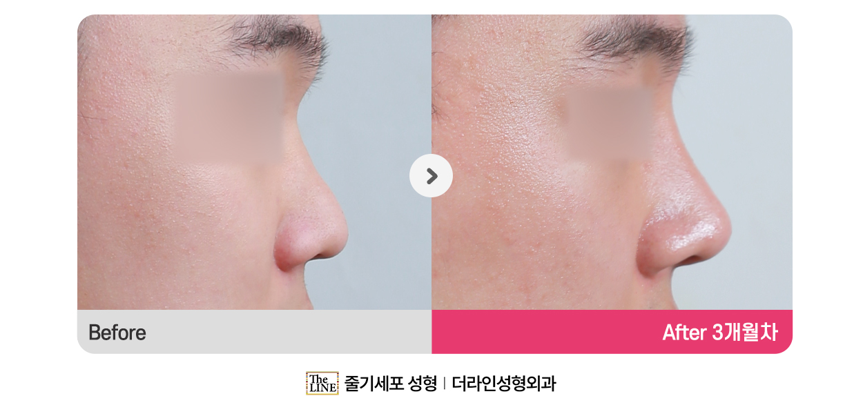 전사진