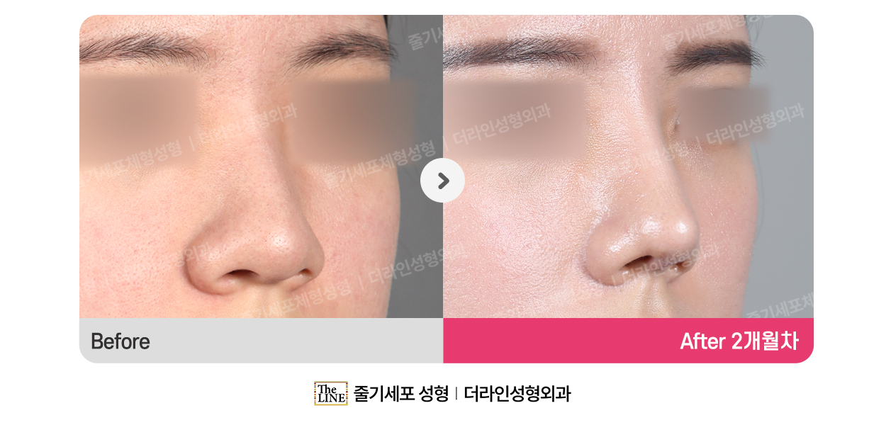 전사진
