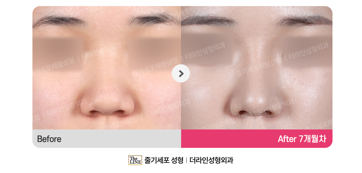 전사진