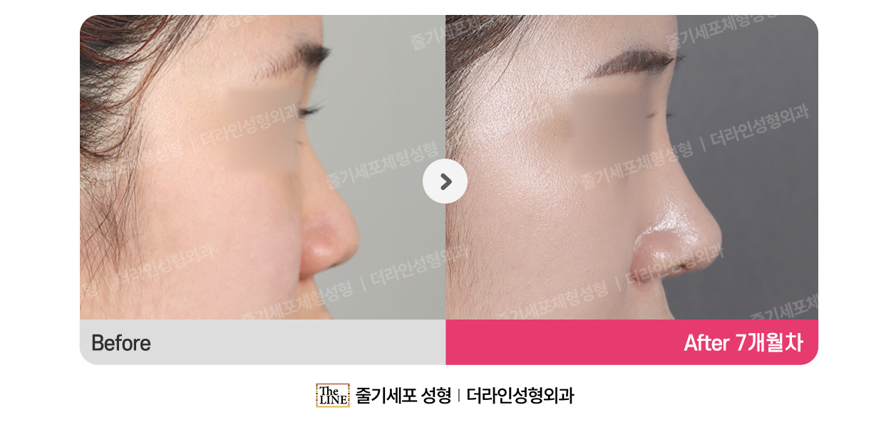 전사진