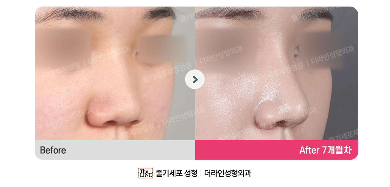전사진