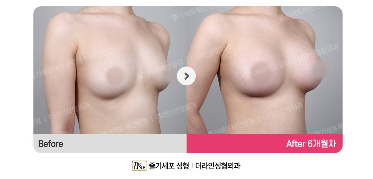 전사진