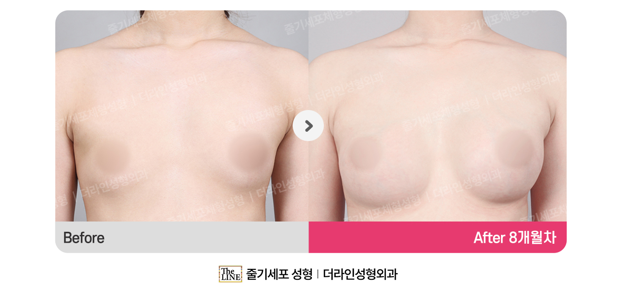 전사진
