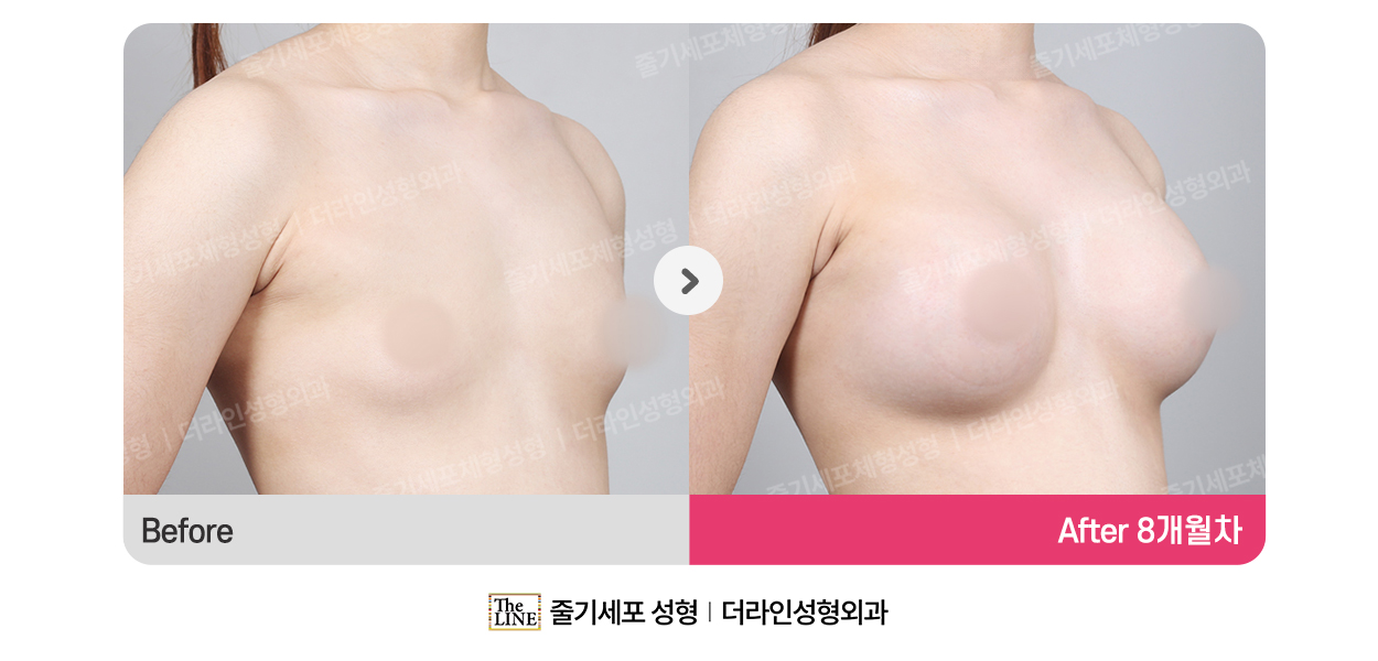 전사진