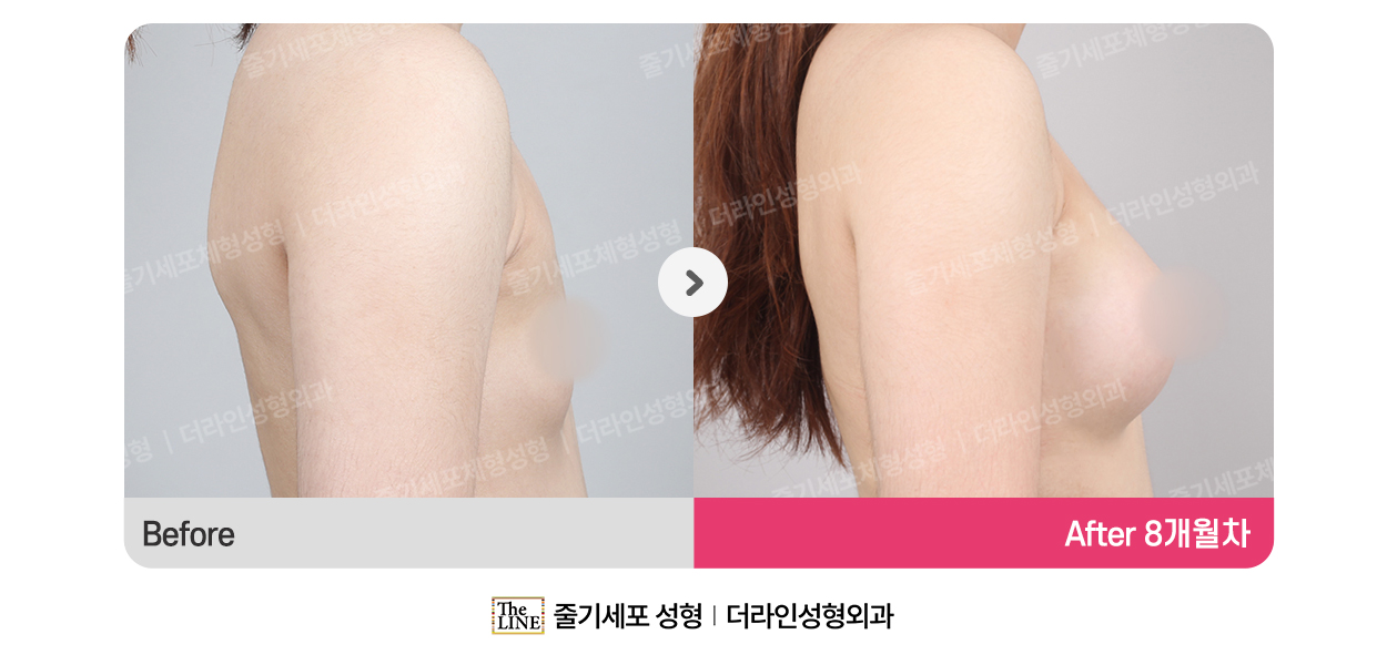 전사진