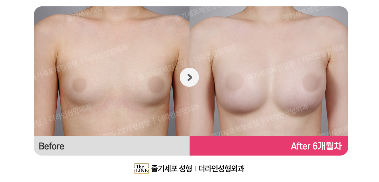 전사진