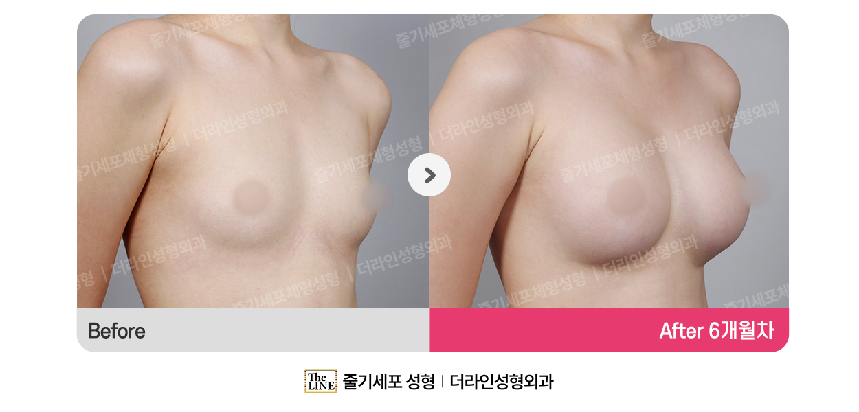 전사진