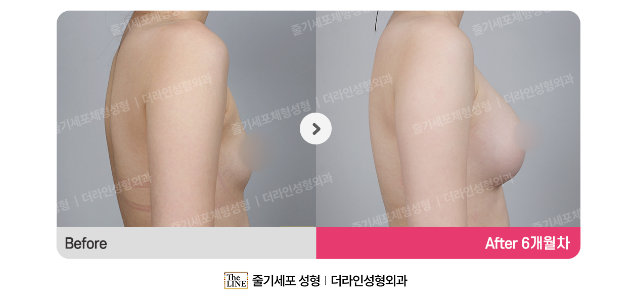 전사진
