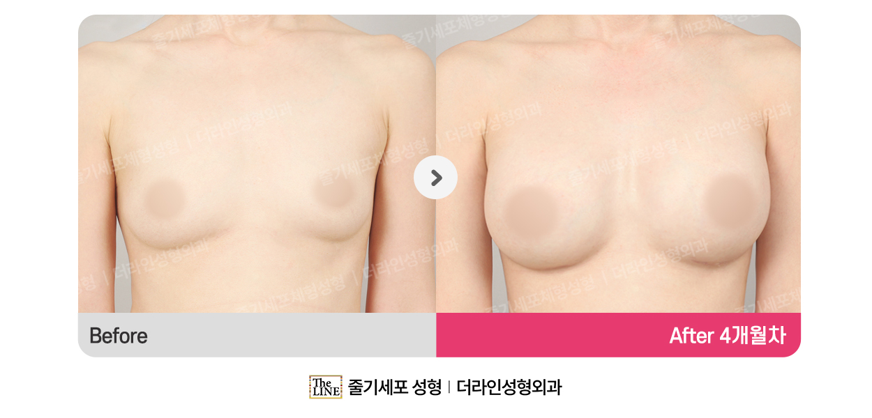 전사진