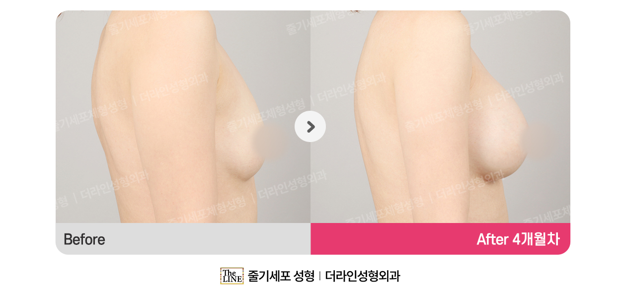 전사진