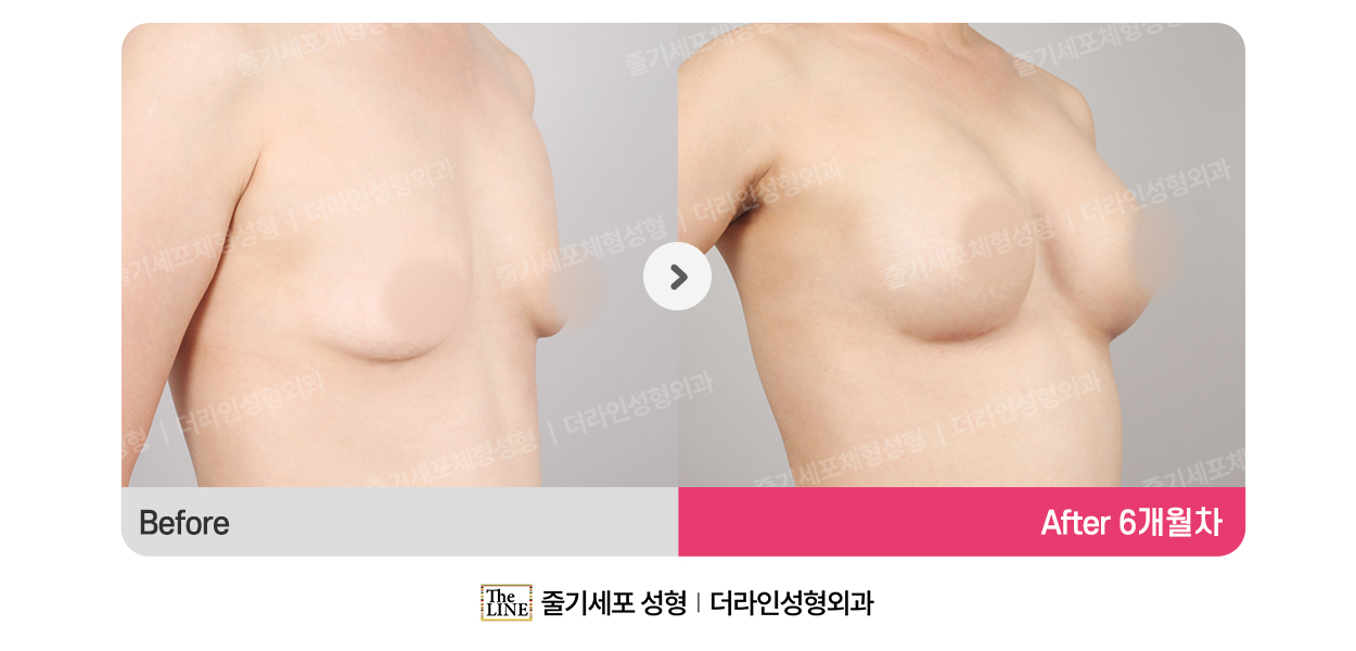 전사진