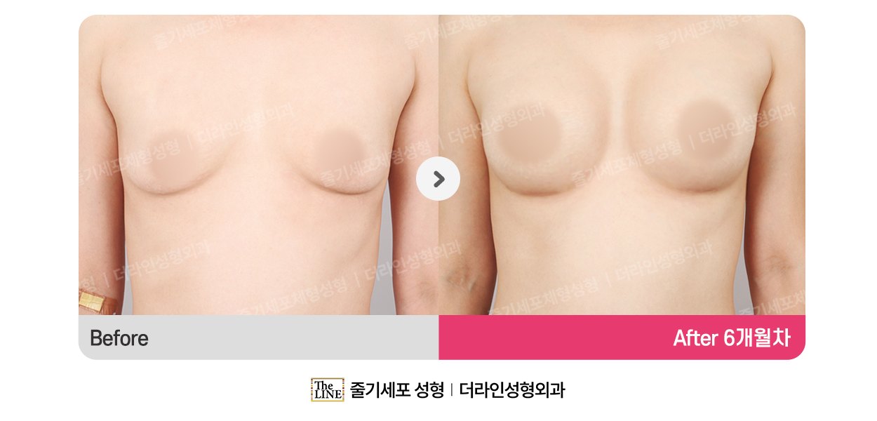 전사진