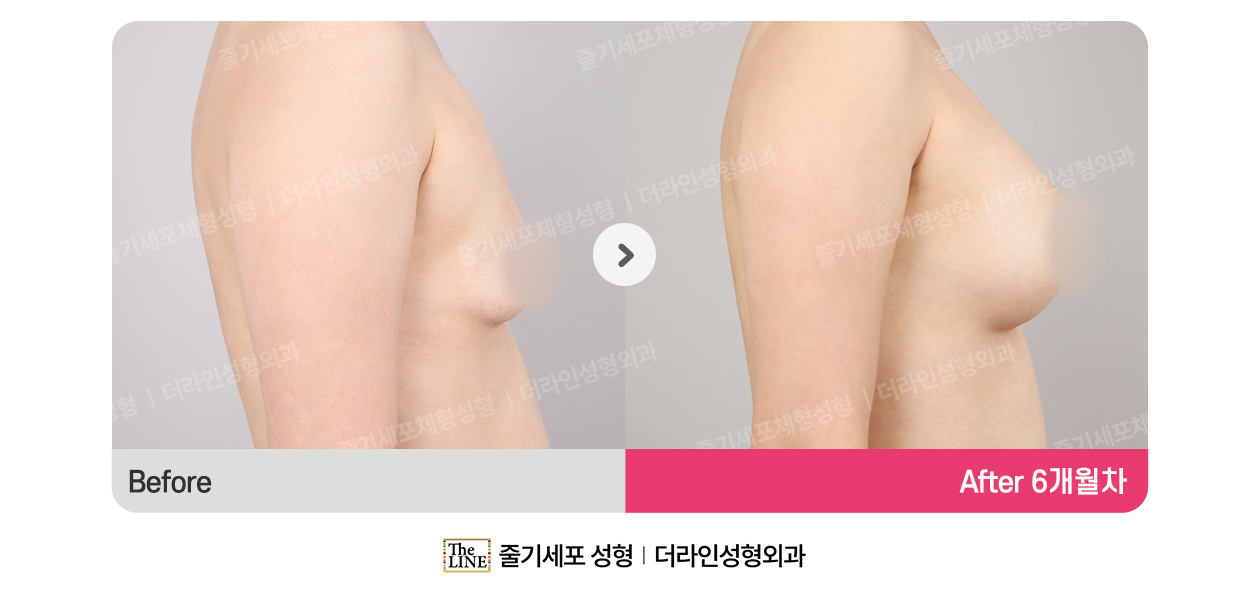 전사진