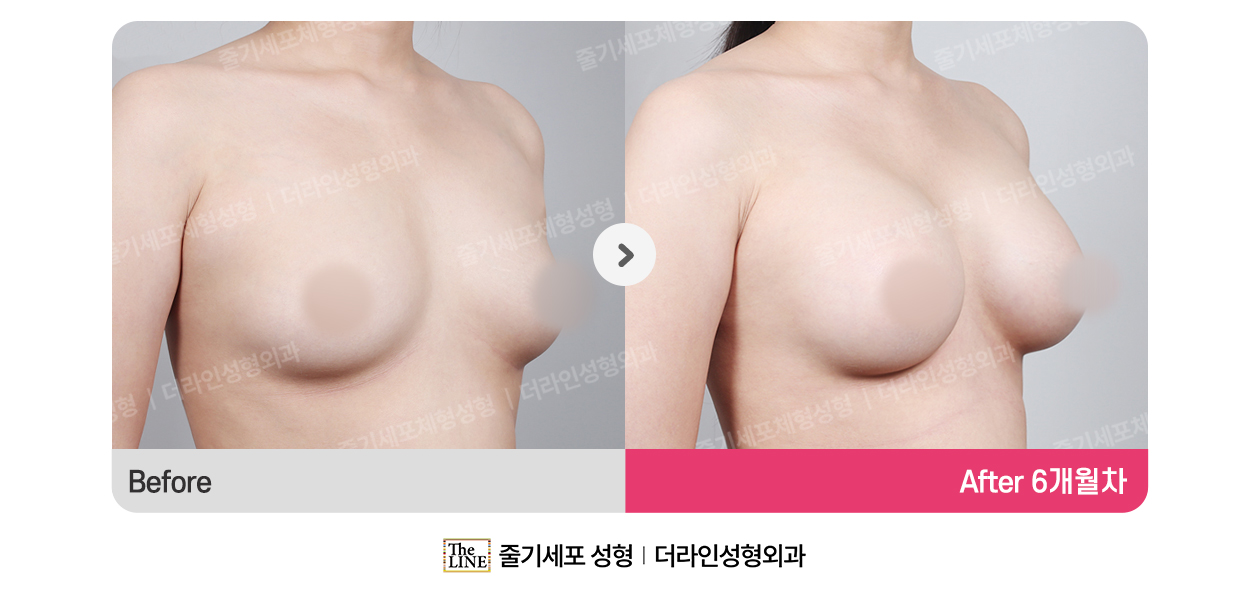 전사진