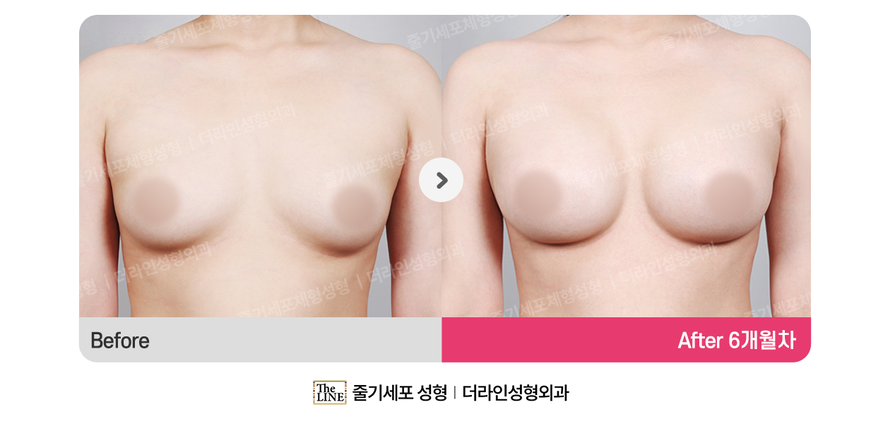 전사진