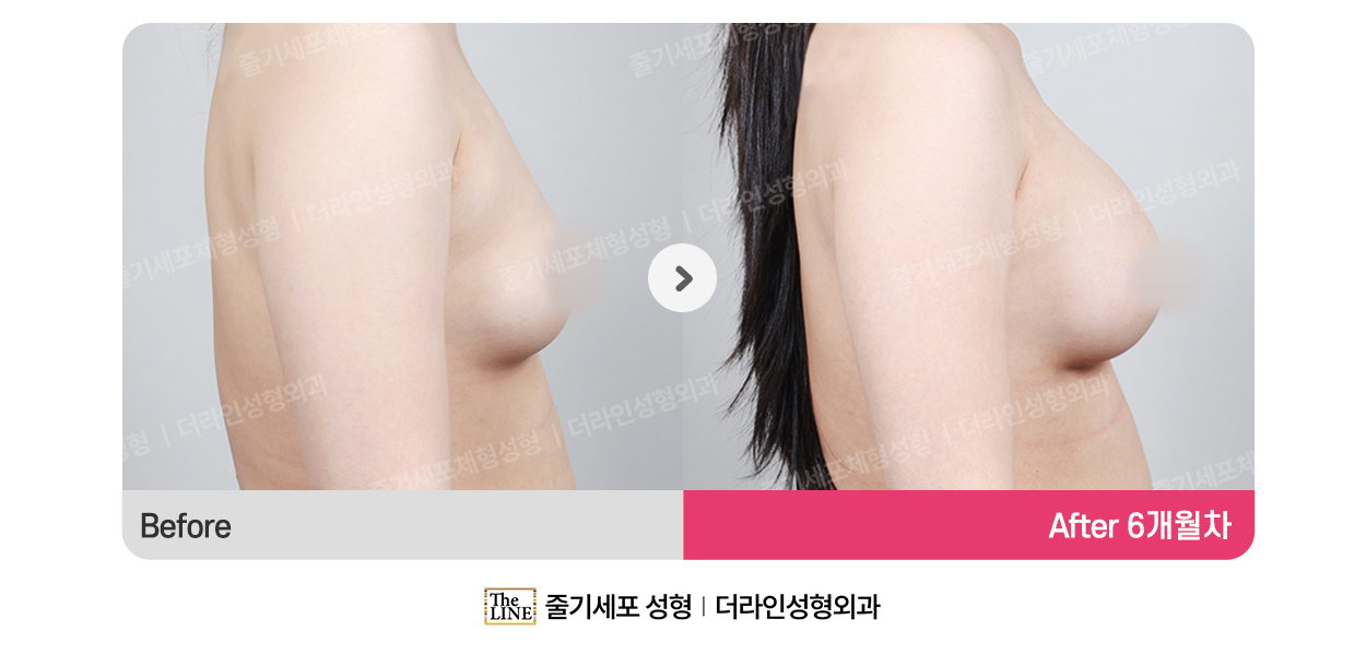 전사진