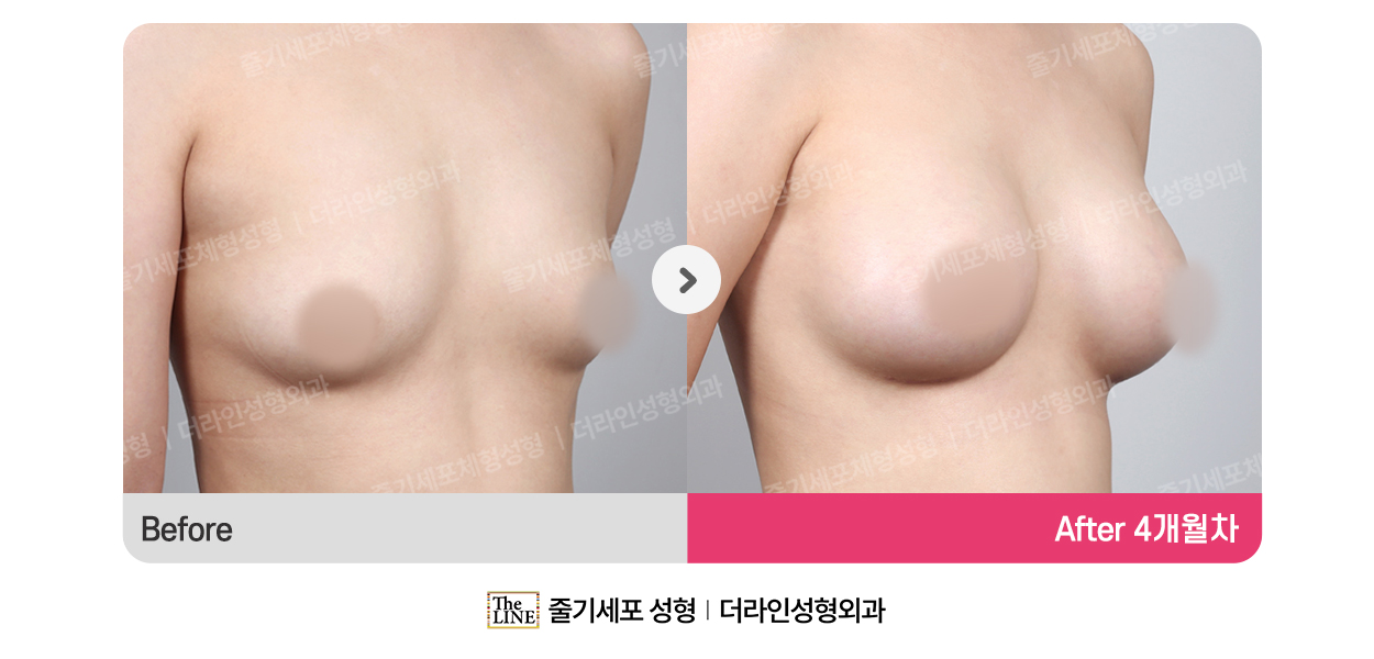 전사진
