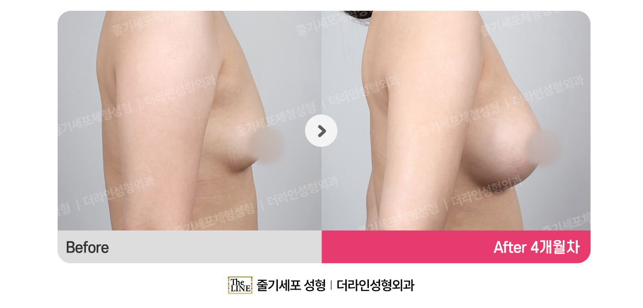 전사진