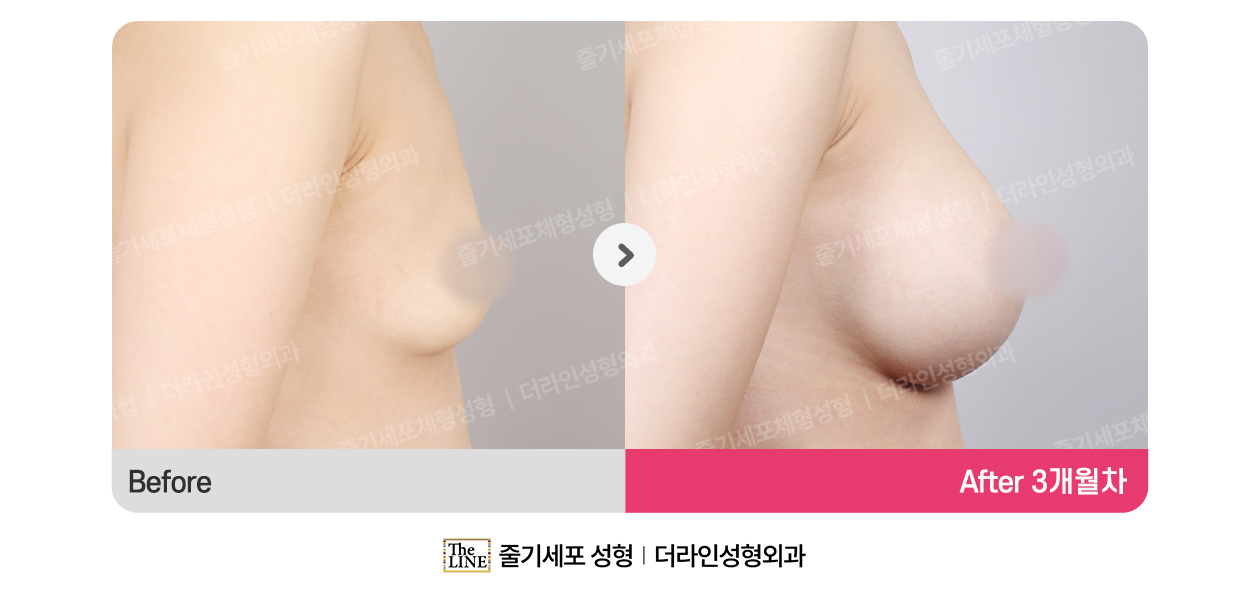 전사진
