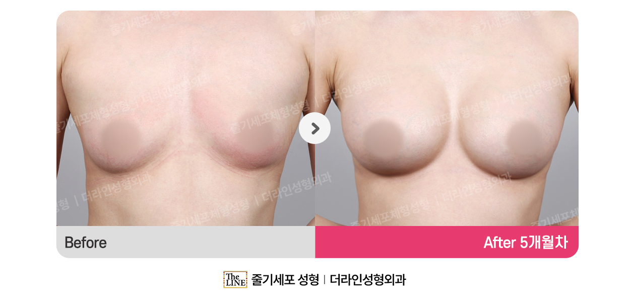 전사진