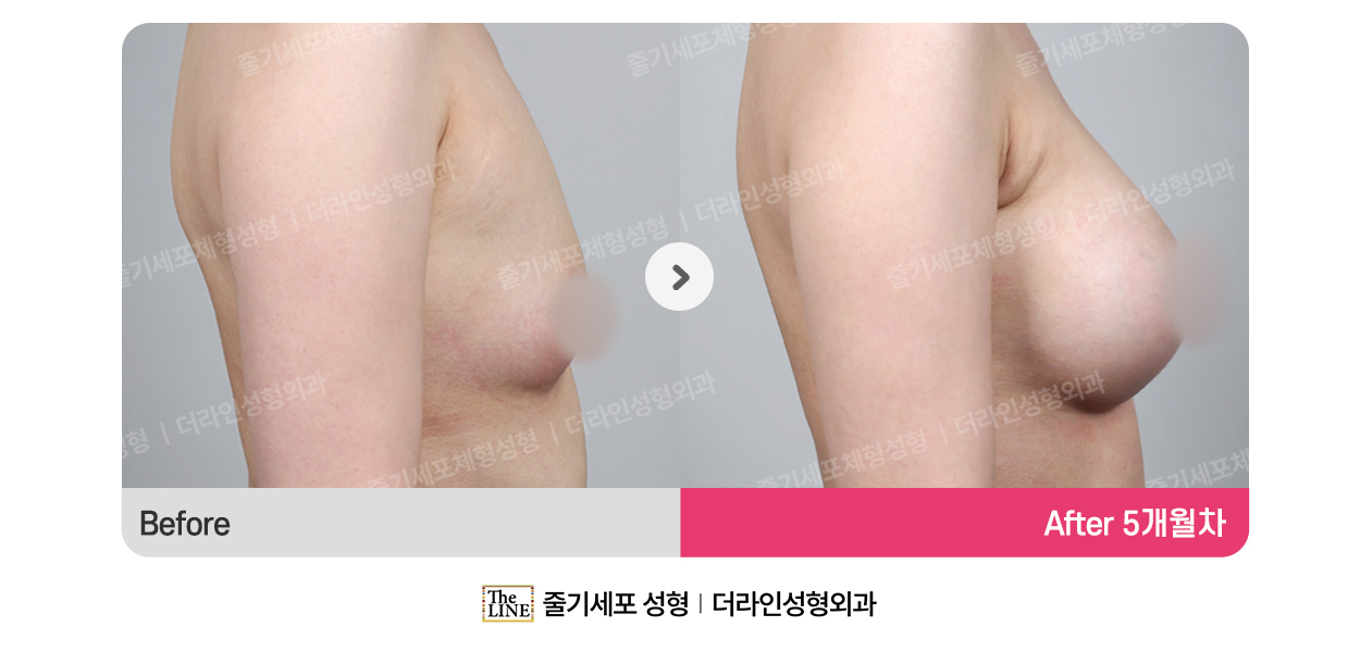 전사진