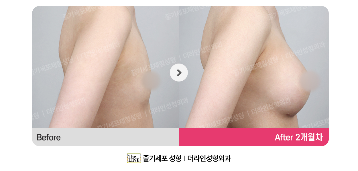 전사진