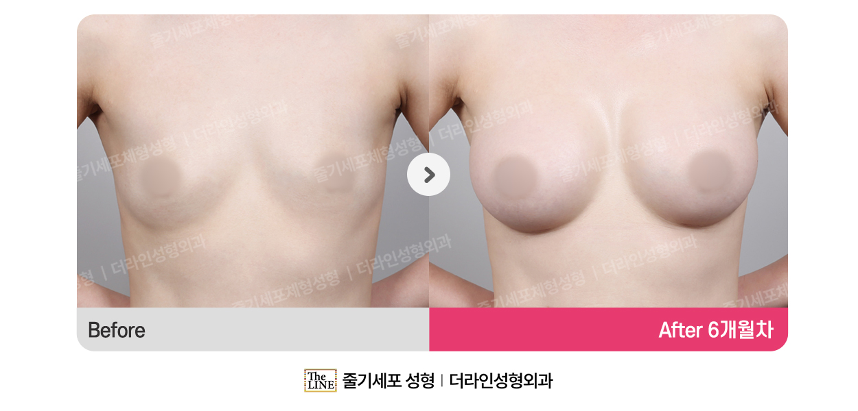 전사진