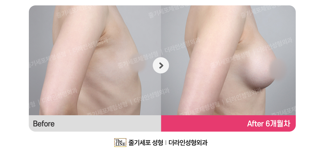 전사진