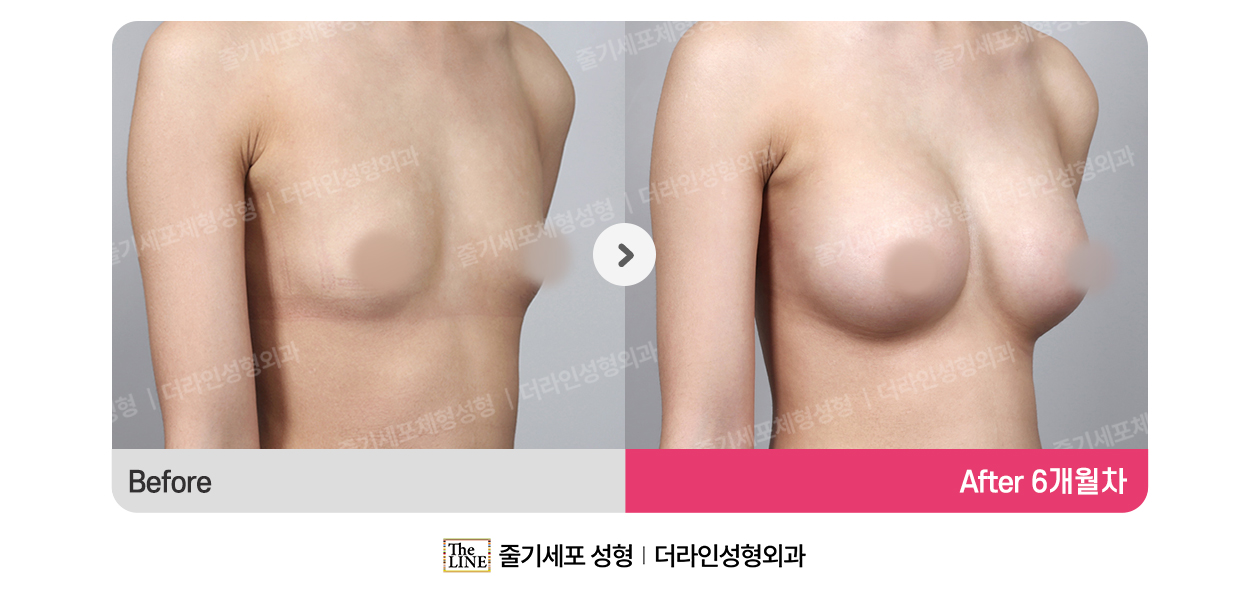 전사진
