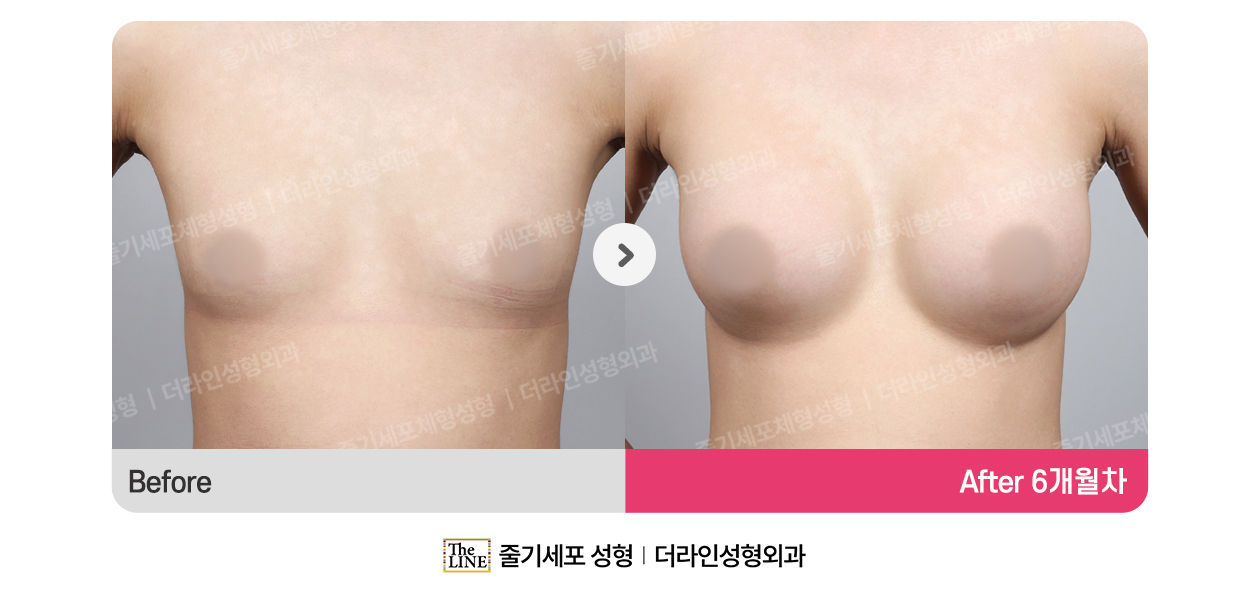 전사진