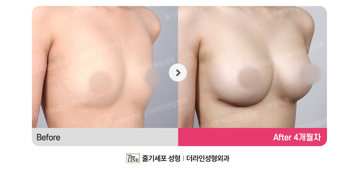 전사진