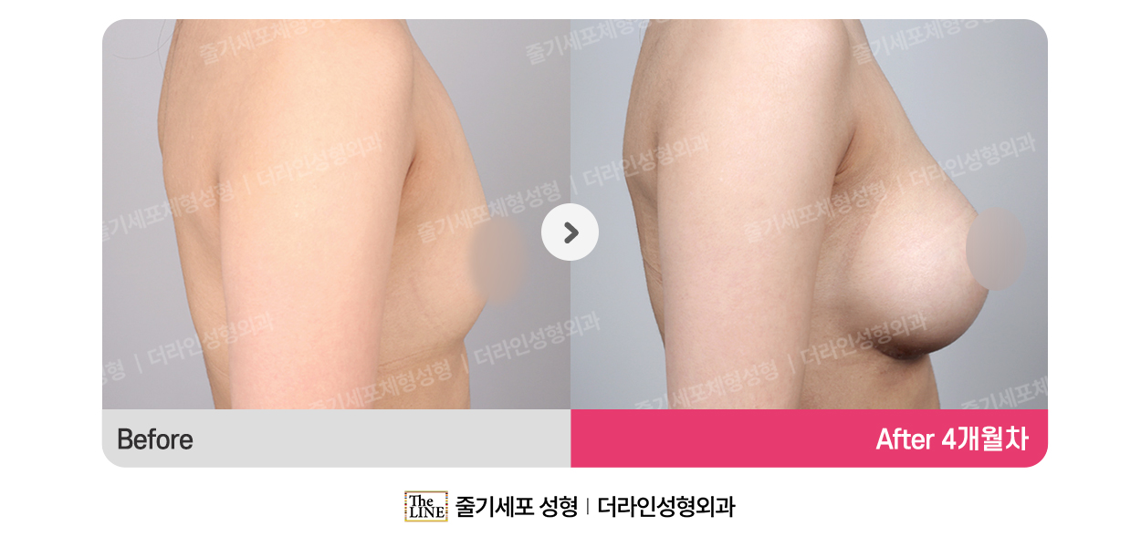 전사진