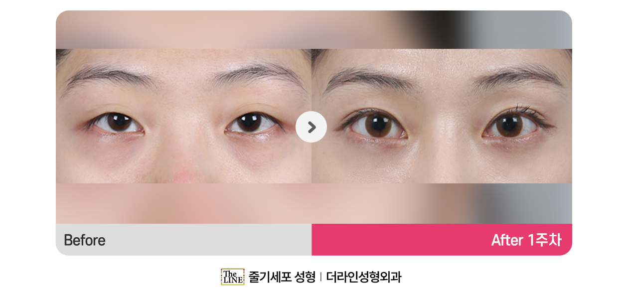전사진