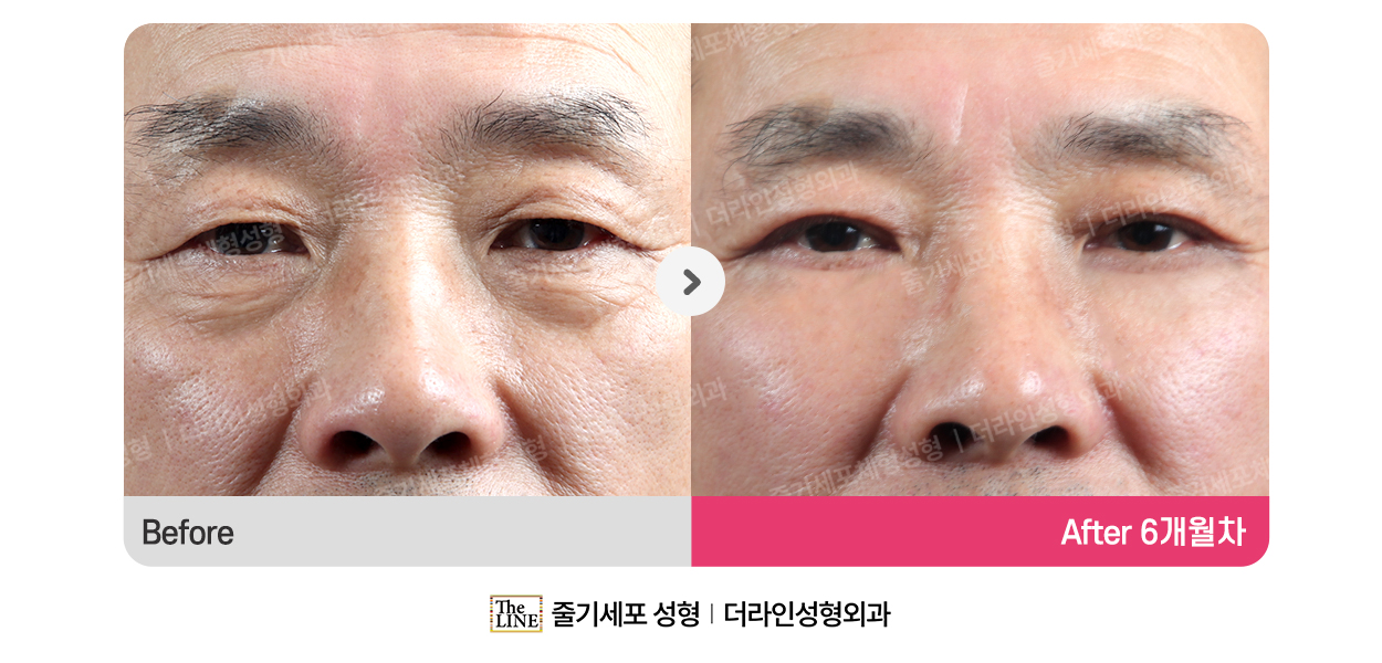 전사진