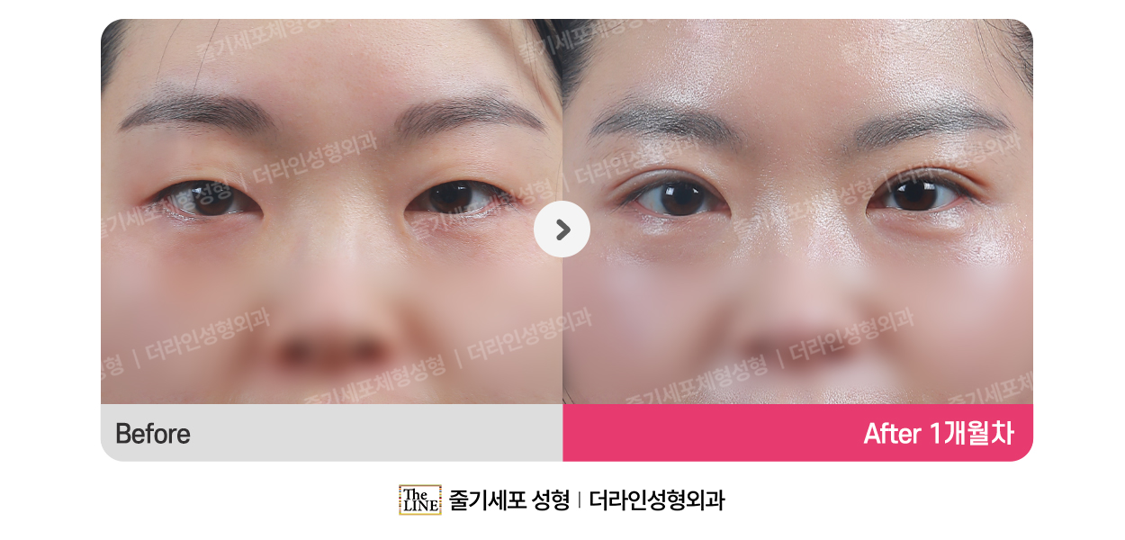 전사진