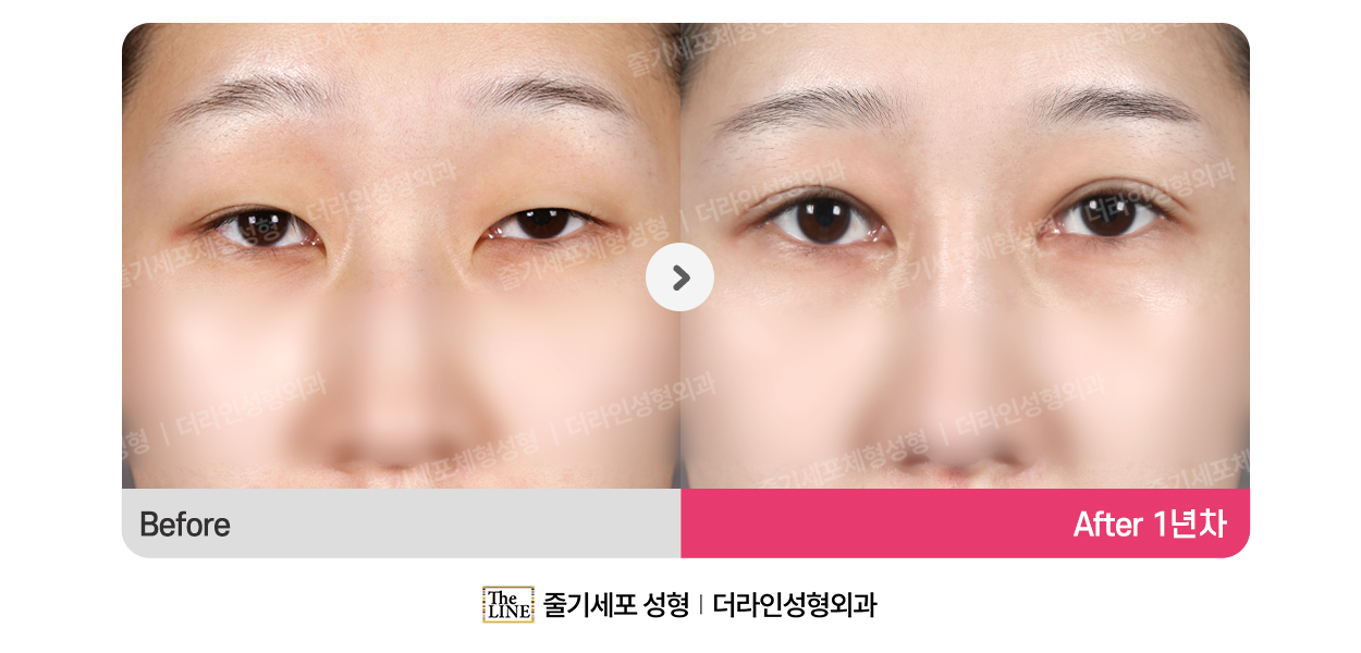 전사진