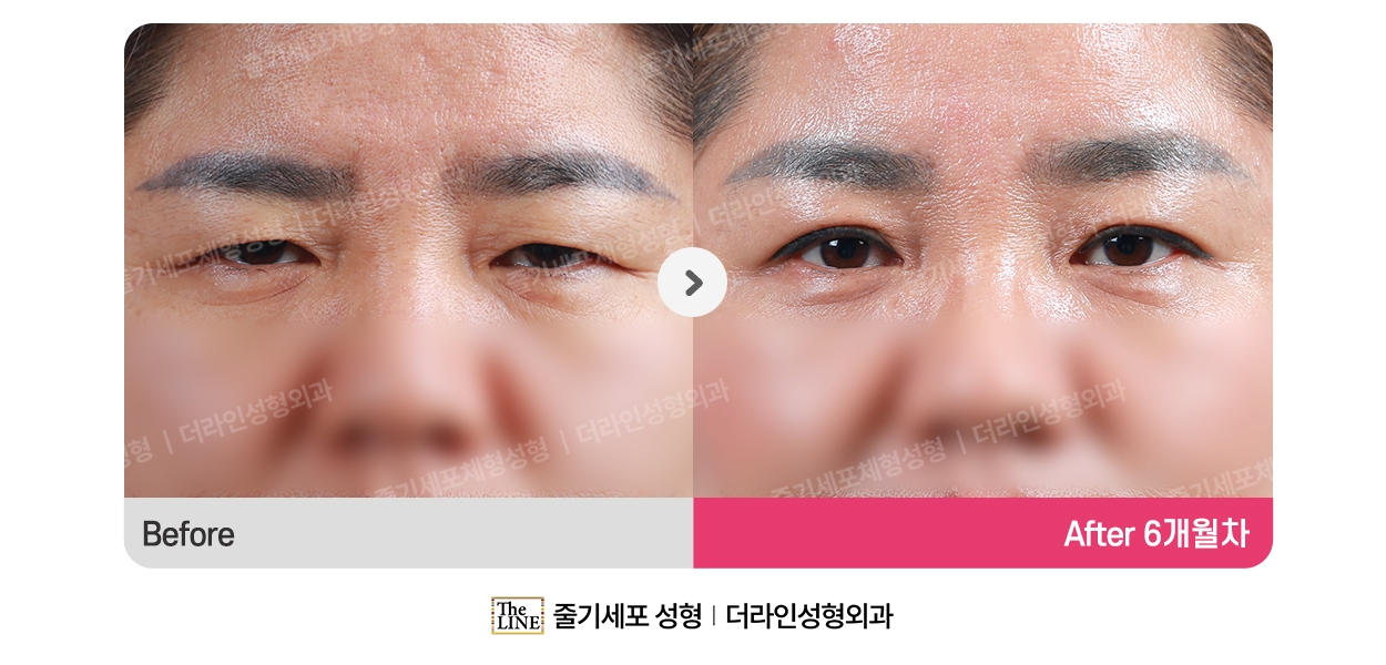 전사진
