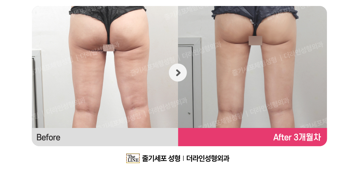 전사진