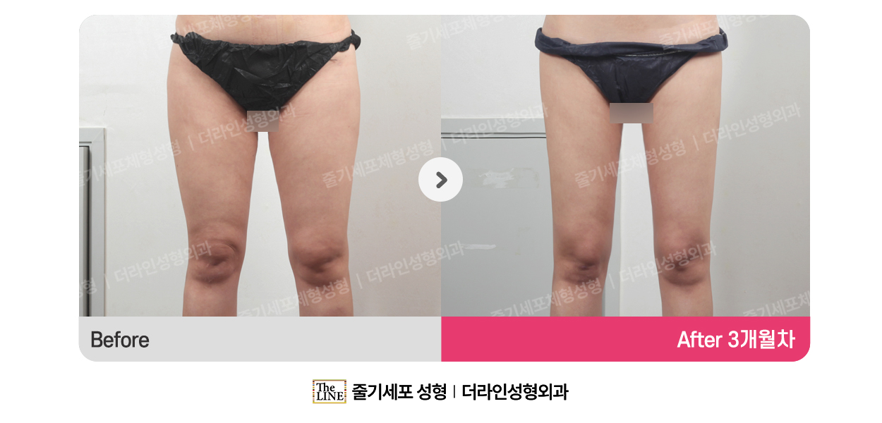전사진