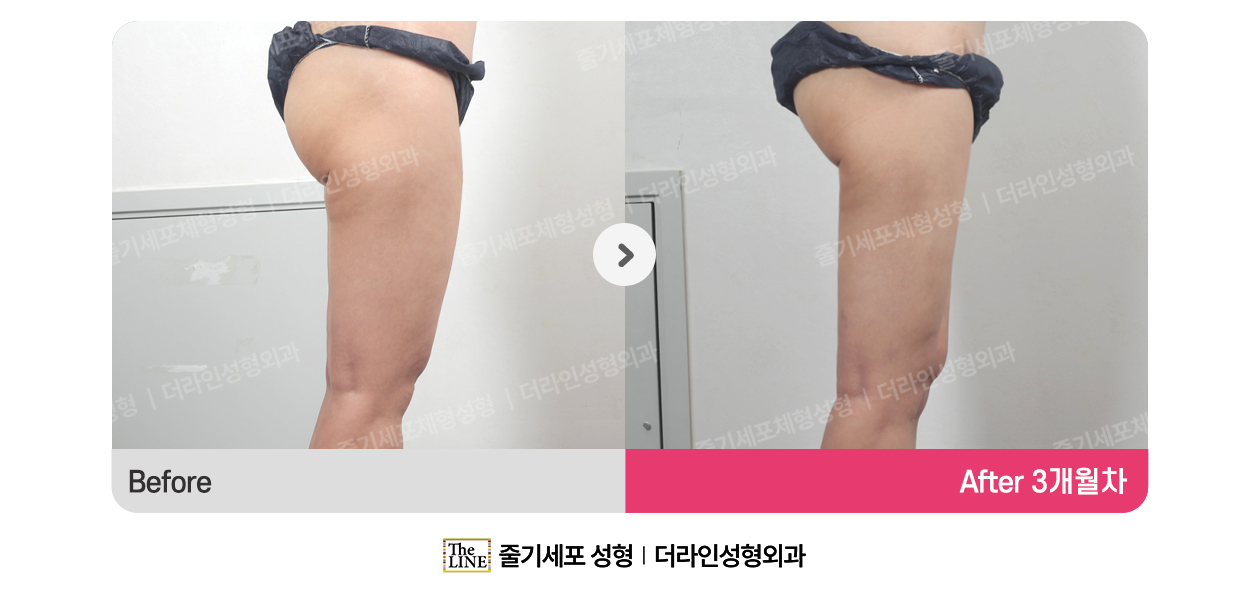 전사진